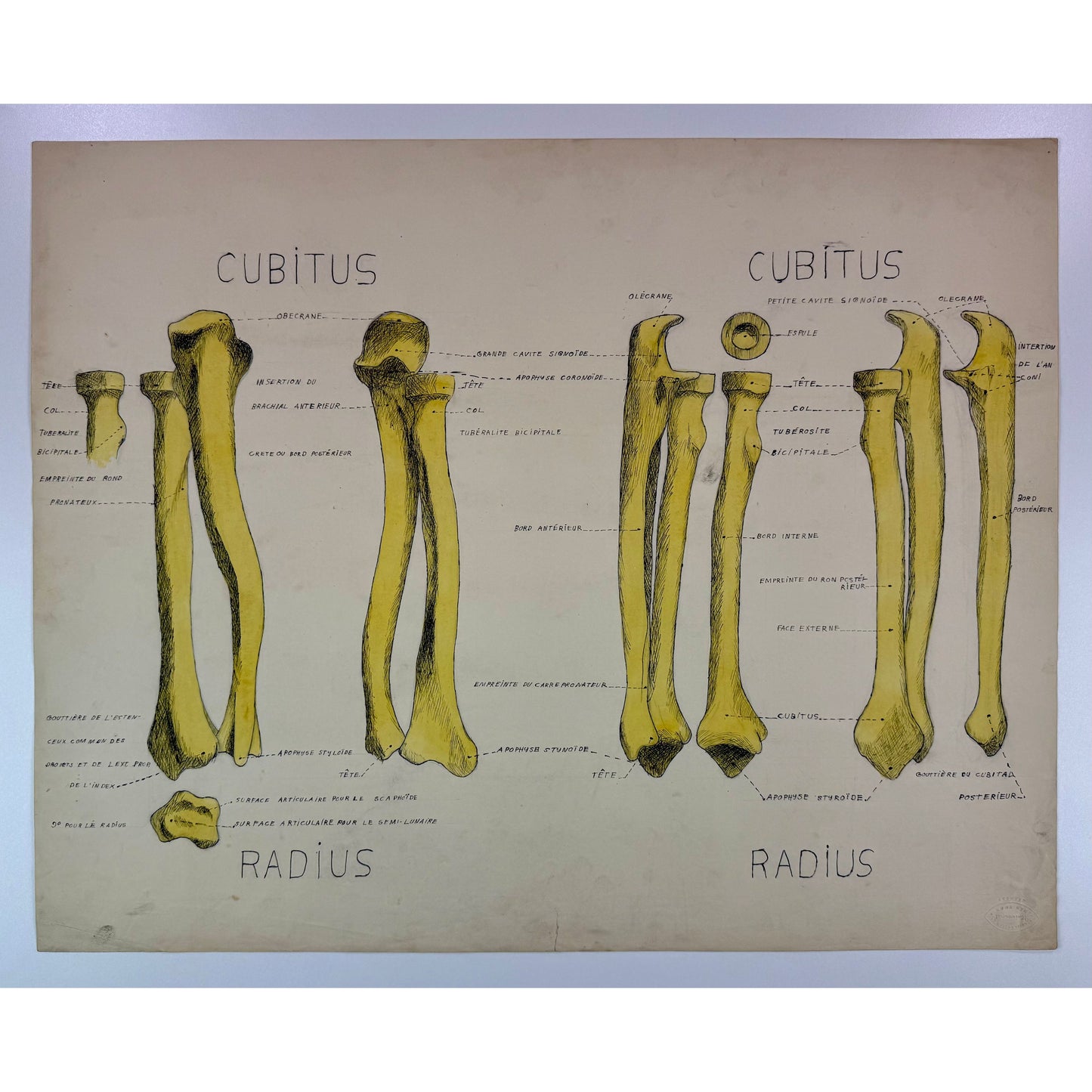 ORIGINAL POSTER - 1930s - ANATOMICAL PLATE / CUBITUS & RADIUS