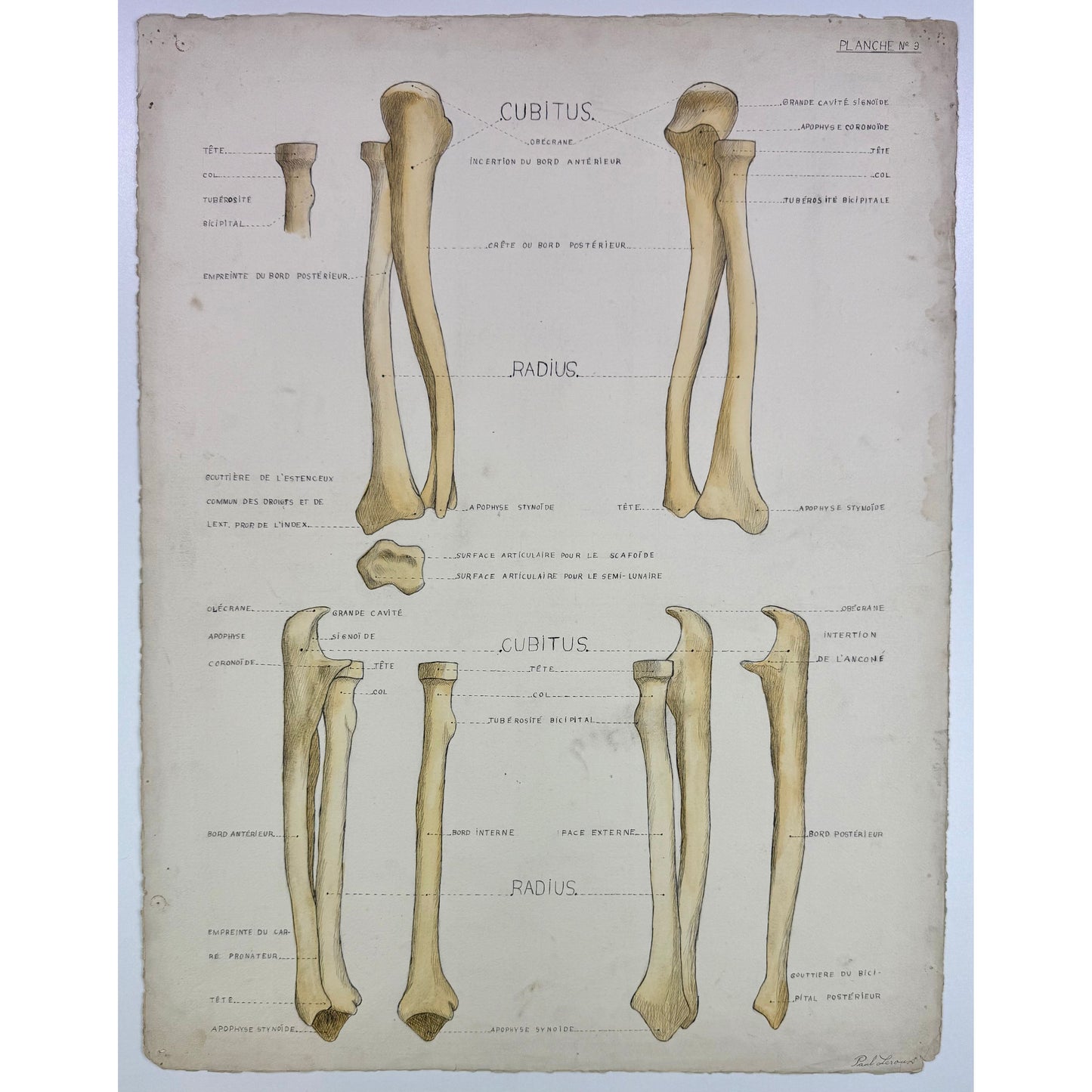 ORIGINAL POSTER - 1930s - ANATOMICAL PLATE / CUBITUS & RADIUS (SIGNED)