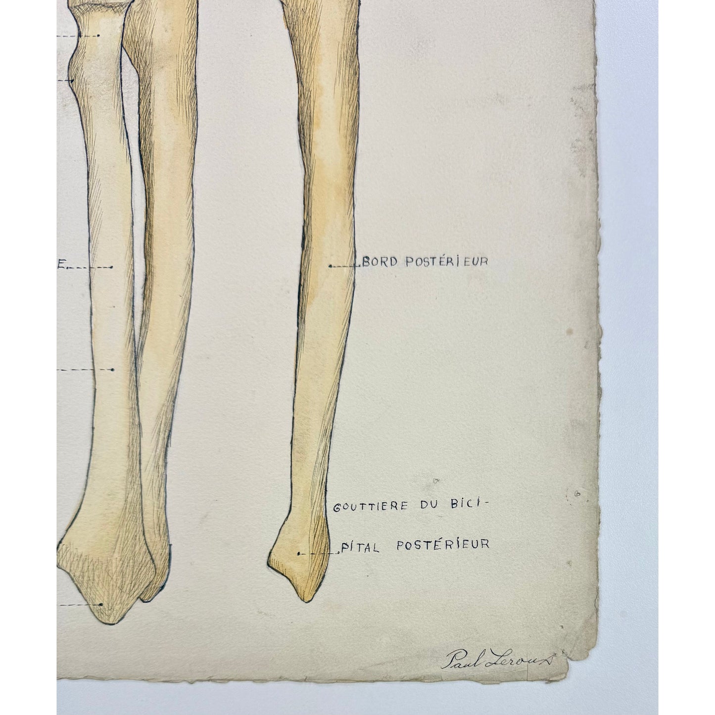 ORIGINAL POSTER - 1930s - ANATOMICAL PLATE / CUBITUS & RADIUS (SIGNED)