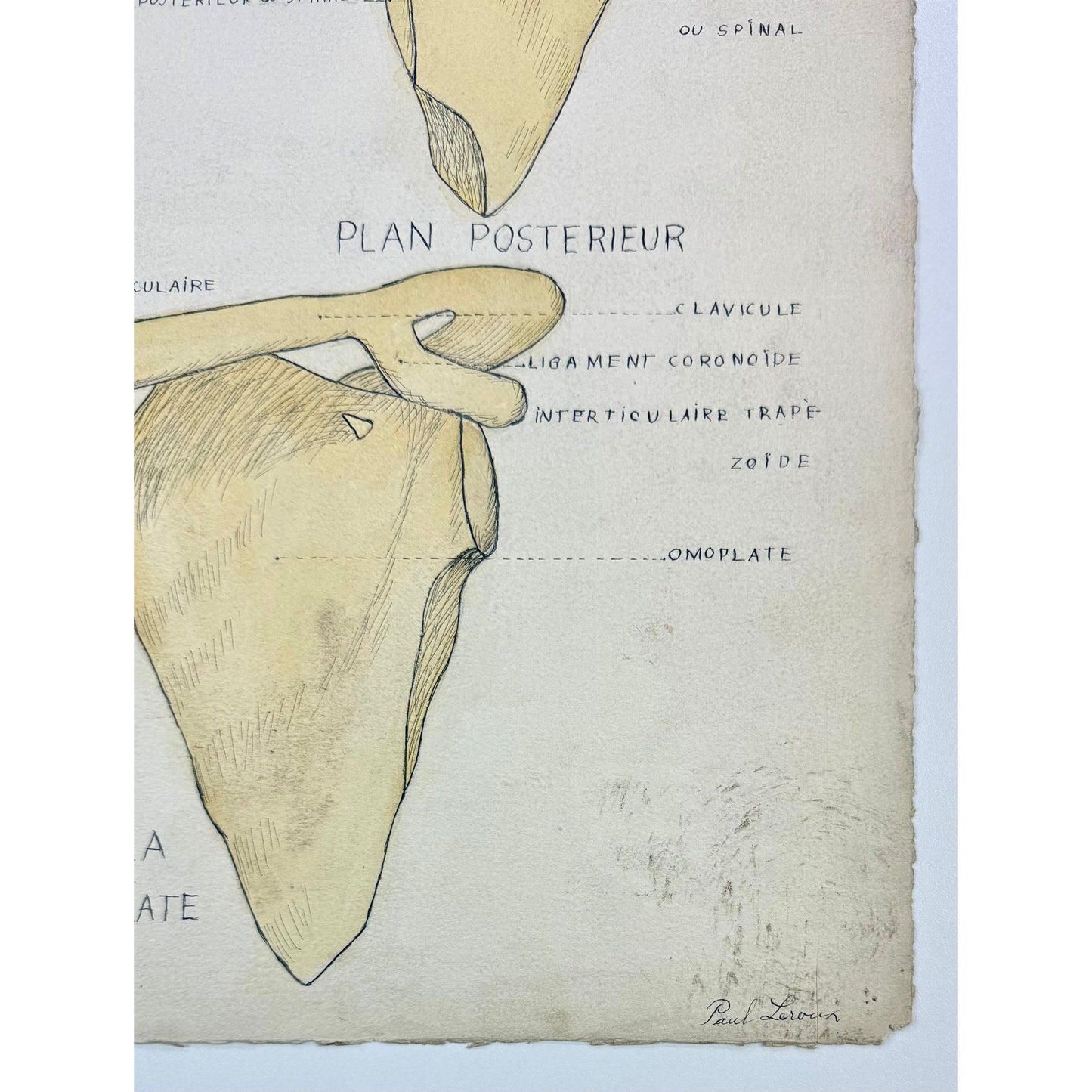 ORIGINAL POSTER - 1930s - ANATOMICAL PLATE / CLAVICULE & OMOPLATE (SIGNED)