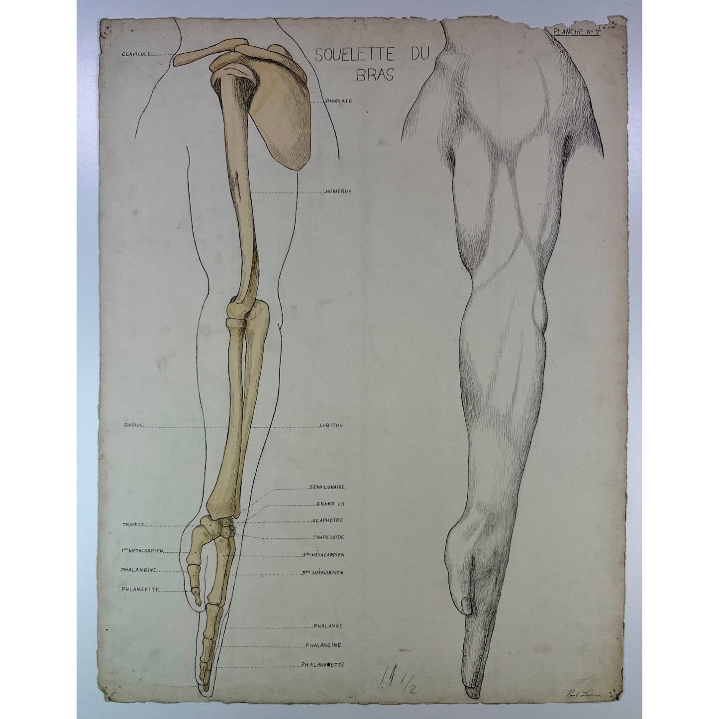 ORIGINAL POSTER - 1930s - ANATOMICAL PLATE / ARM SKELETON (SIGNED)