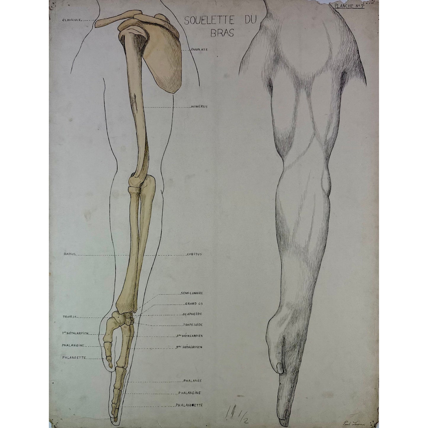 ORIGINAL POSTER - 1930s - ANATOMICAL PLATE / ARM SKELETON (SIGNED)
