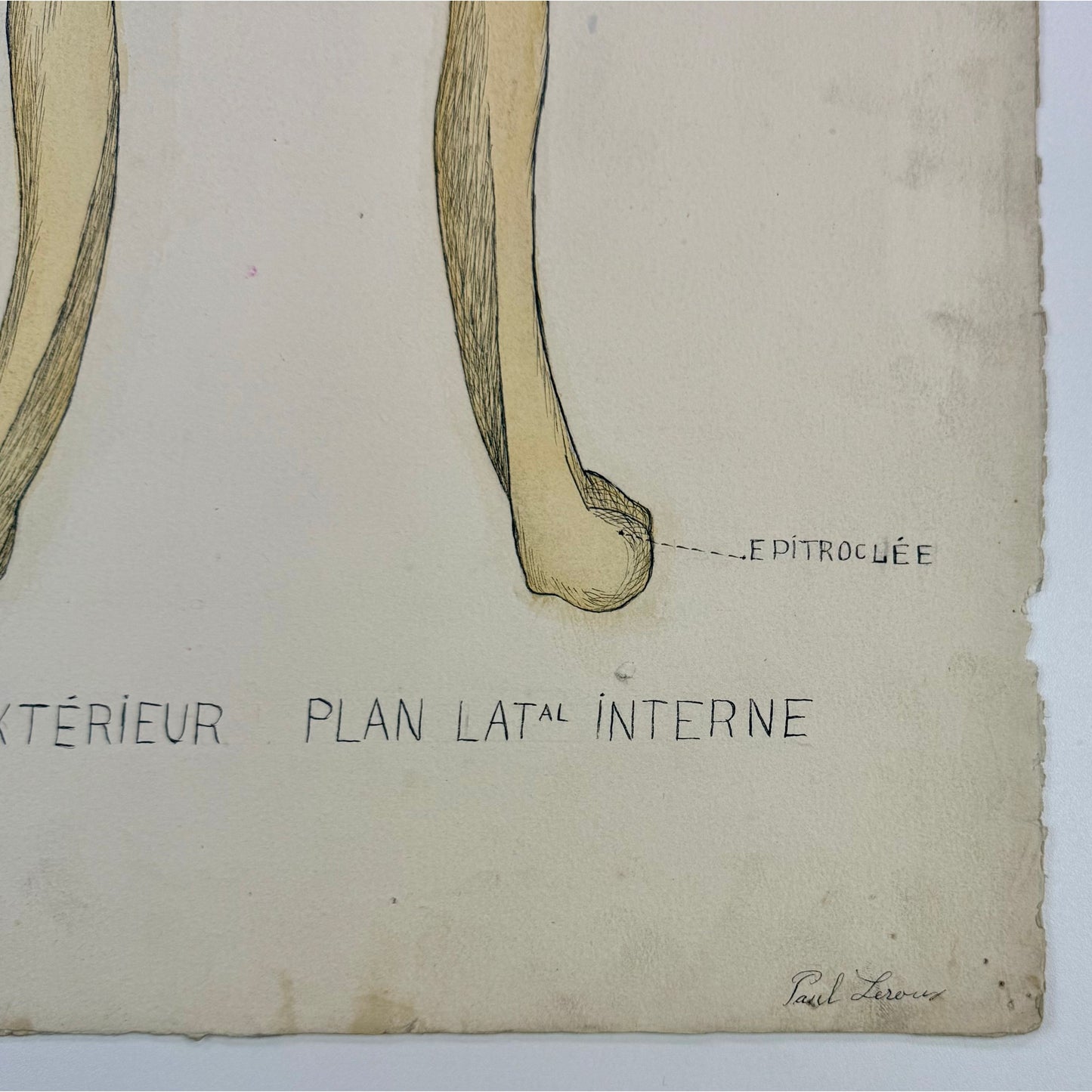 ORIGINAL POSTER - 1930s - ANATOMICAL PLATE / HUMERUS (SIGNED)